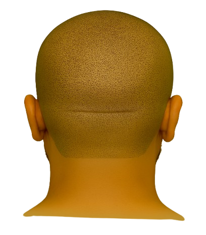 tricopigmentation capillaire Mont de marsan